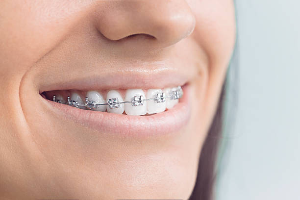 Best Full Mouth Reconstruction  in Franklin, OH